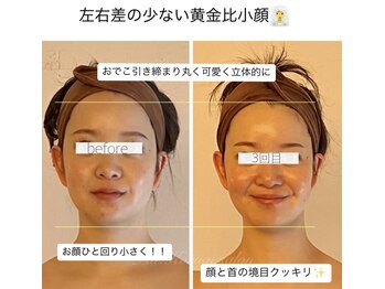 パル コルギサロン(Pal. Korugi salon)/小顔コルギビフォーアフター