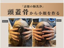 オーク ナチュリ 成城学園前(OAK×NACHUL)の雰囲気（頭蓋骨から小顔にアプローチ！直後から小顔を実感！）