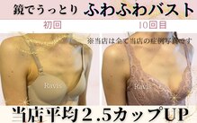 ラヴィス(Ravis)