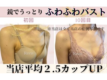 ラヴィス(Ravis)の写真