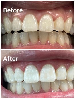 プラチナムビューティー 横須賀店/ビフォーアフター