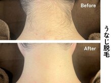 ギルドハナレ(GUILD HANARE)/"自信が持てる後ろ姿に"