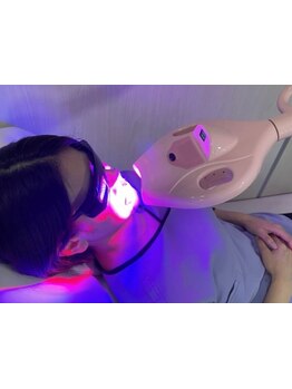 美白ケアをしたい