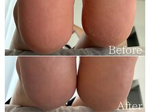 カシェット 広島店(Cachette)/20代女性☆足裏角質ケア90分