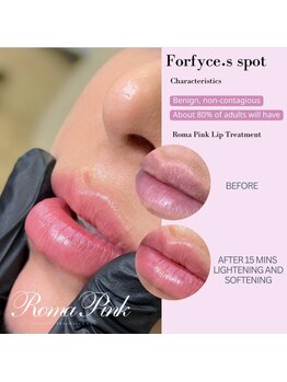 ローマピンク 札幌/一度でピンクリップに♪