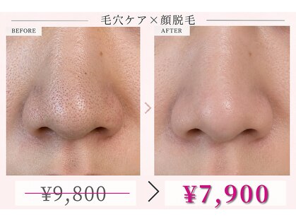 リレイスフクオカ(RelaceFUKUOKA)の写真