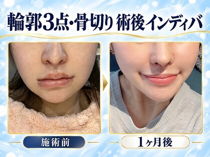 術後インディバ専門サロン 新宿の写真