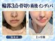 術後インディバ専門サロン 新宿の写真