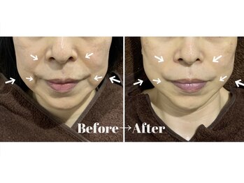 カラーリリー アンド ユン(Calla lily & yun)/気になるシワやたるみに！