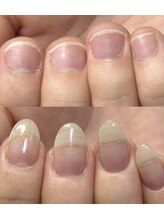 ハッチネイル(HACCI nail)/お客様before after