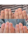 深爪・自爪育成の卒業