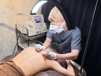 レオナルド(Leonardo)の写真/脱毛最後の砦！１本１本毛穴にプローブを挿入する美容電気脱毛◎白髪・しつこいヒゲ・硬毛化にも対応！