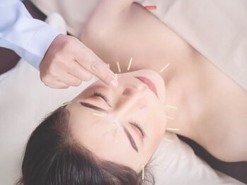 ルソール(Le seul)の写真/【人生で一番輝く日のために】ブライダル専門コースで小顔・痩身が叶う全身美容鍼