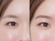 リノ(Lino)の写真/最先端アイブロウソリューション!<リピート率No.1>の人気メニュー★HBLで叶うワンランク上の美眉に導きます