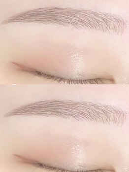 白美の写真/フェイシャルやアイブロウ、脱毛との組み合わせメニューがオススメ☆お顔のキレイをすべてかなえるサロン◎