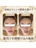 初回体験【小顔/脂肪撃退/リフトUP】特殊なマシンで速攻小顔¥15000→¥12000