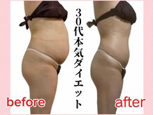 ウィズルーチェ 神栖店(with luce)の雰囲気（30代・産後の本気ダイエットでご来店。マイナス8キロでこの変化）