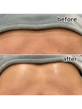 レイモード(Ray mode)/BBLバストケア