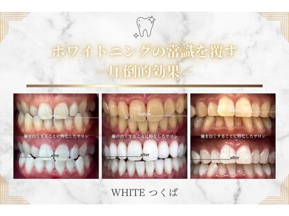 ホワイト つくば店(WHITE)の写真