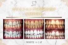 ホワイト つくば店(WHITE)