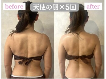 ウンスイスパ(UNSUI SPA)/天使の羽ケア