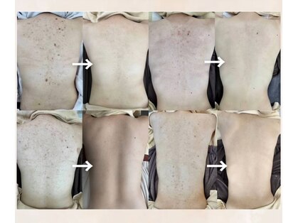 スキンプローズ(skinprose)の写真