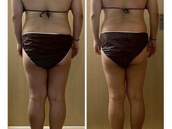 ココア(CoCoa)/活性リンパ洗浄