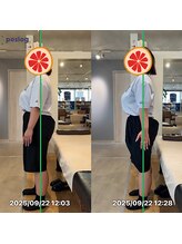 グレフル鍼灸接骨院 整体院 心斎橋/整体/肩こり/マッサージ/腰痛