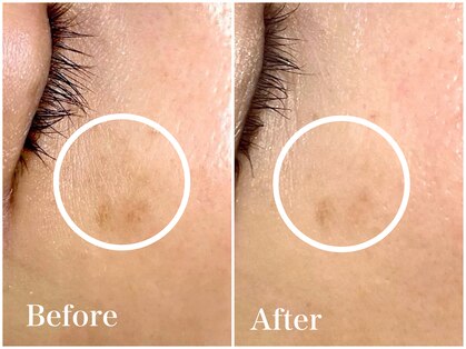 ラウレア(LAULEA)の写真