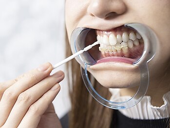 シロサロン(silo salon)の写真/初めてのセルフホワイトニングならsilo salonで決まり！丁寧なカウンセリングと高技術を通いやすい価格で◎