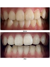 コアルナ センター北店(Coalna)/歯科提携・セルフホワイトニング