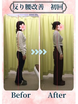 アミーゴ整体院/ビフォーアフター