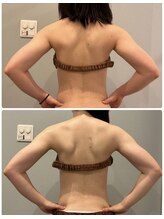 サロン ド フェイス モアナ(Salon de Faith Moana)/ブライダル痩身【20代】