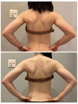 サロン ド フェイス モアナ(Salon de Faith Moana)/ブライダル痩身【20代】