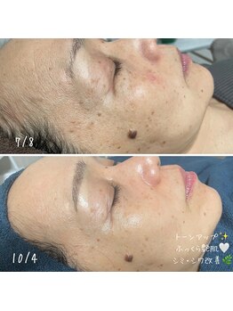 ソランザサロン(Solan the salon)/エイジングケアにも効果的