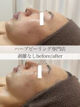 ルヴィショップ 大阪心斎橋(REVISHOP) 顔が一回り 変わる
