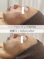 ルヴィショップ 大阪心斎橋(REVISHOP) 顔が一回り 変わる