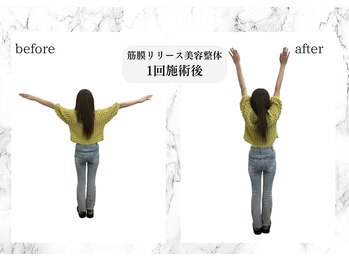 トキ(TOKI)/筋膜リリース美容整体 施術後