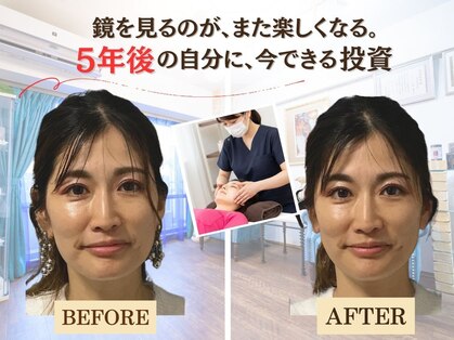 プレフェランス(Preference)の写真