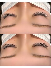 エストカラー 浦和美園(est calla)/フラットラッシュ140本