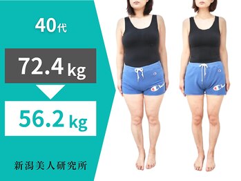 新潟美人研究所/-16.2kgでショートパンツ履けた!