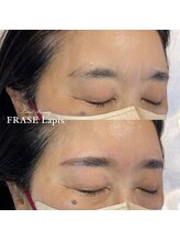 フレイズラピス(FRASE Lapis)/【ハリウッドブロウリフト】