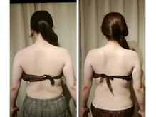 サクラス(SUQRAS)/ビフォーアフター/5回