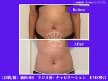 フェレザ 新潟(Felleza)/筋肉増強持久力アップの効果期待