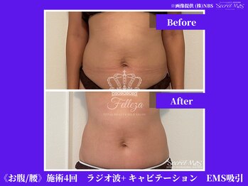 フェレザ 新潟(Felleza)/筋肉増強持久力アップの効果期待