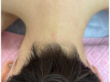 シャラン(sharan)の雰囲気（脱毛が初めてで不安の方も久しぶりの方もお気軽にご相談下さい♪）