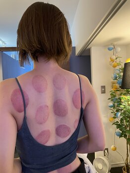 フェイス 72 トーキョー 浅草橋(Faith 72 TOKYO)/巡り整うカッピング美容