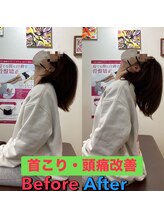 ヒデ整体院(Hide整体院)/猫背矯正骨盤矯正B/A肩こり腰痛