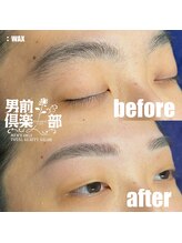 男前倶楽部/脱毛/メンズ脱毛/メンズ専門店