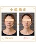 【美小顔矯正/シルエット整体】小顔/たるみ改善/顔の左右差 美容整体¥11000→